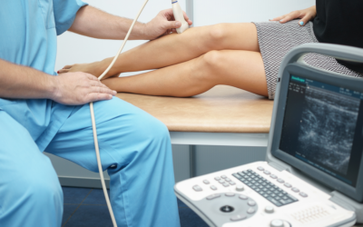 ULTRASOUND FOR DVT SURVEILLANCE